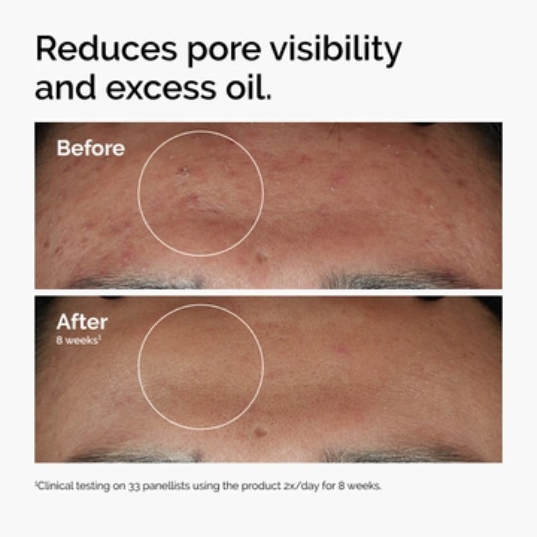Niacinamide 10% + Zinc 1% • 30ml