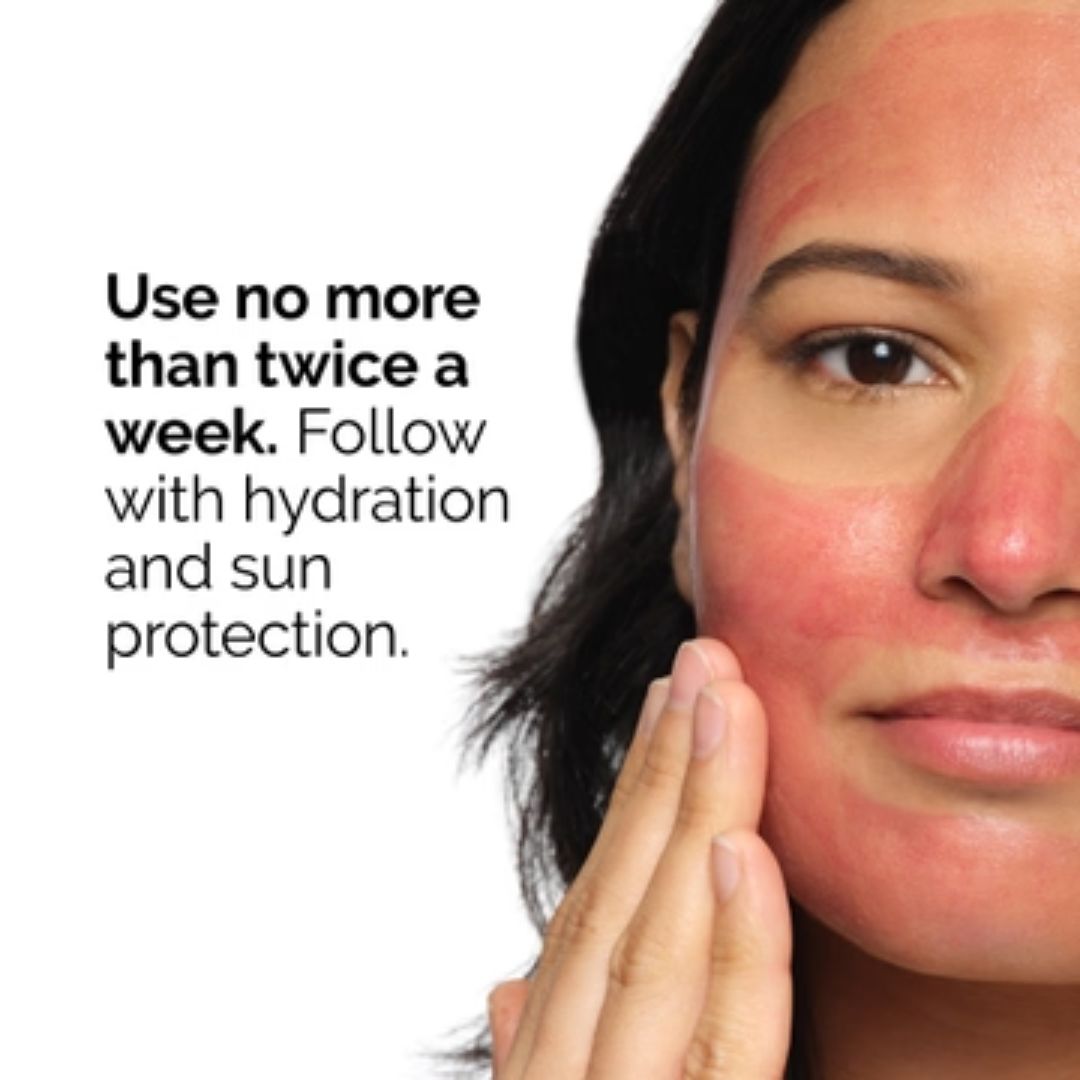 AHA 30% + BHA 2% Peeling Solution • 30ml